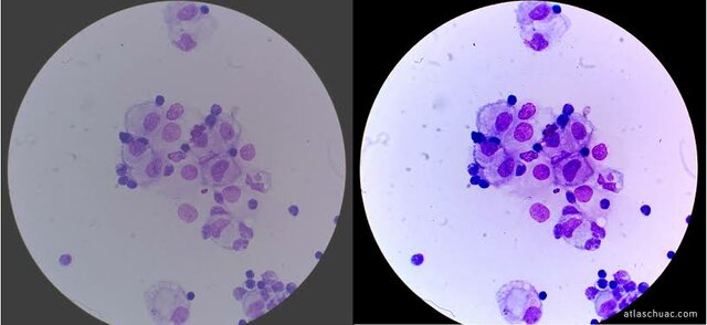 Iluminación Köhler