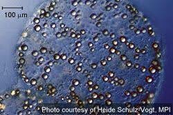 Thiomargarita namibiensis "Perla de azufre de Namibia".