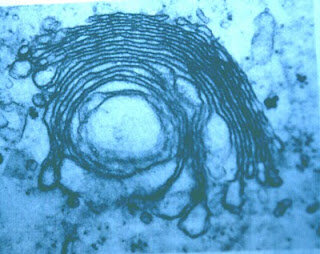 Descubrimiento del Aparato Golgi
