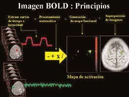 Aplicación de la tomografía por resonancia magnética con ayuda de señales de BOLD.