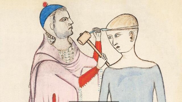 Trepanaciones craneales