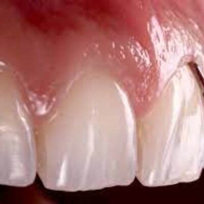 Timeline: LÍNEA DEL TIEMPO DE LA PERIODONTOLOGÍA