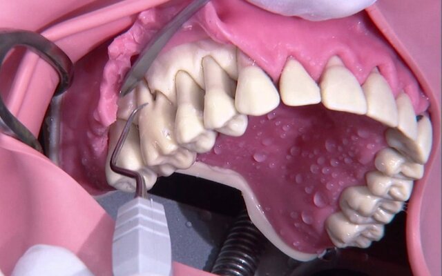 CIRUGÍA PERIODONTAL