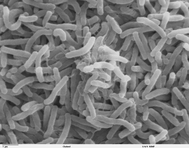 Virus del cólera