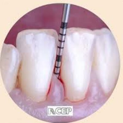 Timeline: Historia de la periodoncia