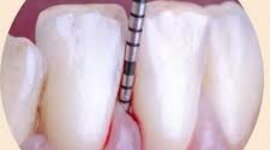 Timeline: Historia de la periodoncia