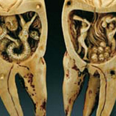 Timeline: HISTORIA DE LA ENDODONCIA