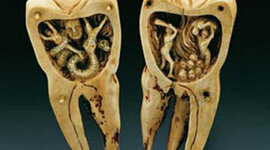 Timeline: HISTORIA DE LA ENDODONCIA