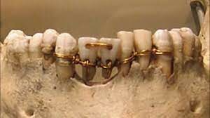 1200-146 a.C. CIVILIZACIONES ANTIGUAS