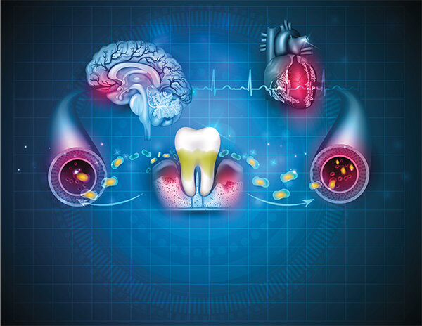 ÉPOCA INFECCIÓN FOCAL DE 1910 a 1928