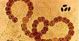 "Teoría microbiana de la enfermedad"