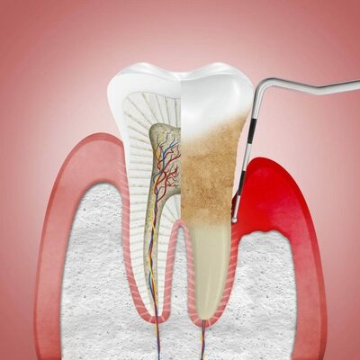 Timeline: PERIODONTOLOGIA - CARREON VEGA MAURICIO 1309
