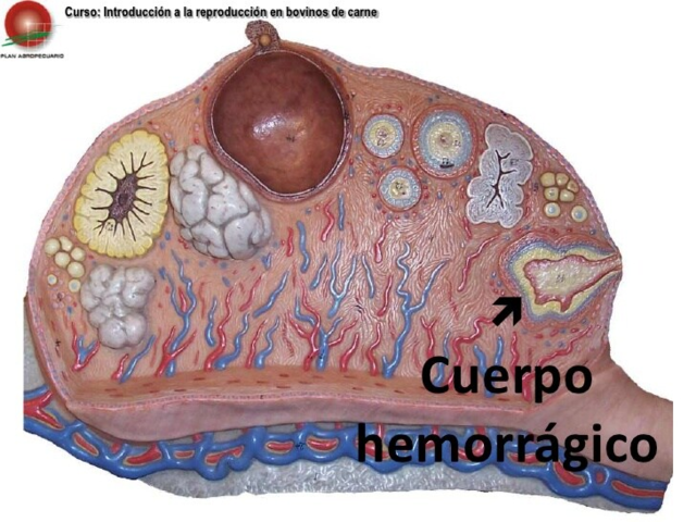 Cuerpo hemorrágico