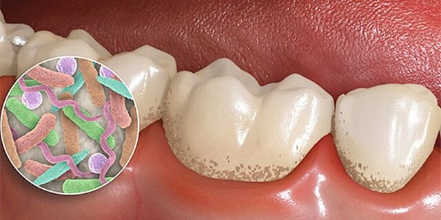 BIOLOGIA DEL PERIODONCIO