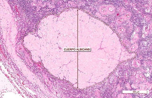 Cuerpo albicans