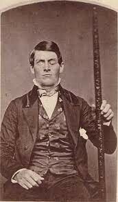 Phineas Gage (obrero de ferrocarriles) 1823-1860