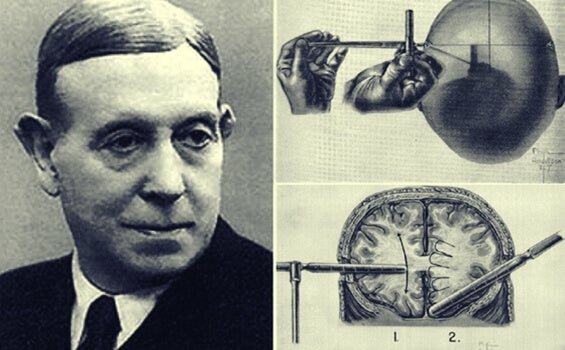 Egas Moniz  (Psiquiatra y neurocirujano) 1874-1955