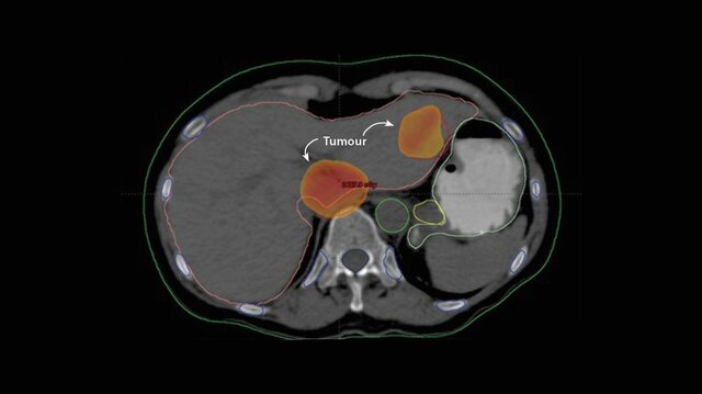Avances tecnológicos y científicos en la medicina.