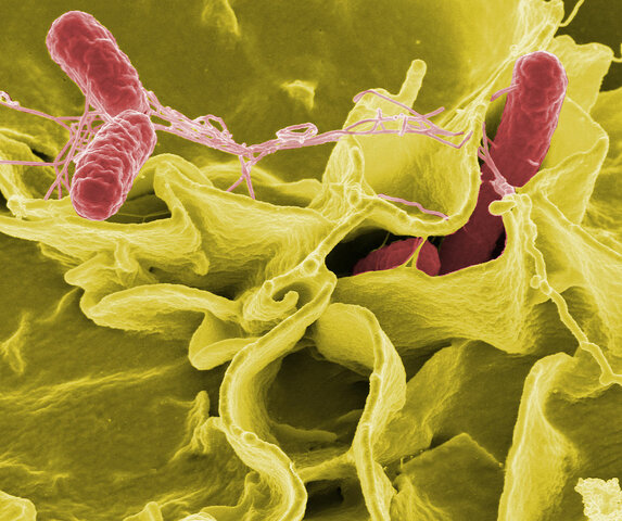 1892 Los microbios patógenos,