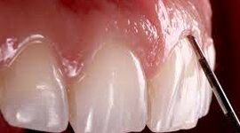 Timeline: Periodontología