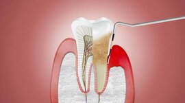 Timeline: HISTORIA DE LA PERIODONCIA