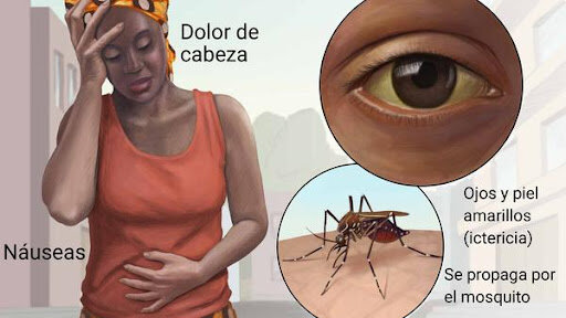 La fiebre Amarilla 1850
