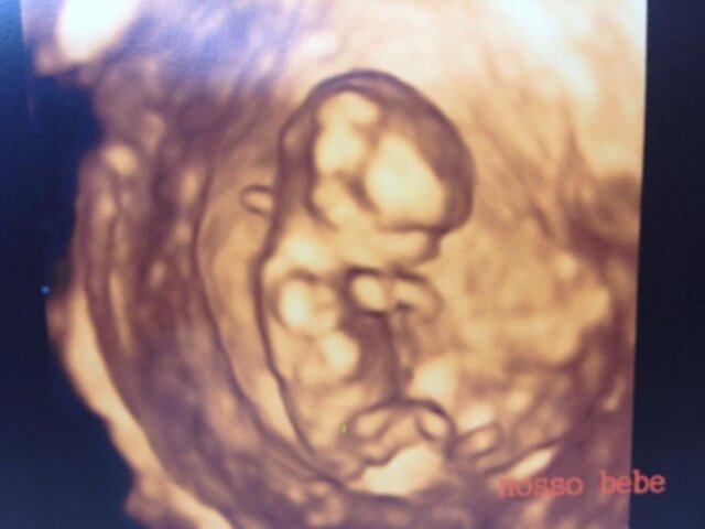 Eu na barriga da mamãe