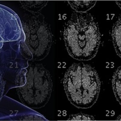 Timeline: Historia de la Nueropsicología