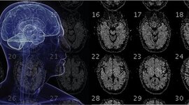 Timeline: Historia de la Nueropsicología