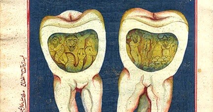Un texto sumerio describe los “gusanos dentales” como causa de la caries dental.
