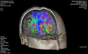 Imagenes Funcionales