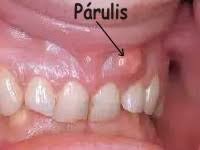 Cepillado dental por las noches