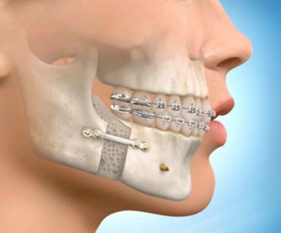 Cirugía Maxilofacial