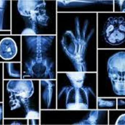 Timeline: Radiología Convencional