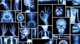 Timeline: Radiología Convencional