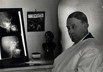 Angiografía por Contraste