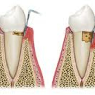 Timeline: Historia de la Periodontología