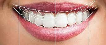 Estética en la odontología