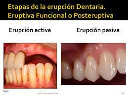 Historia Natural del Diente