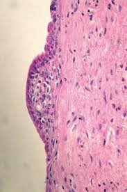 Histopatología periodontal