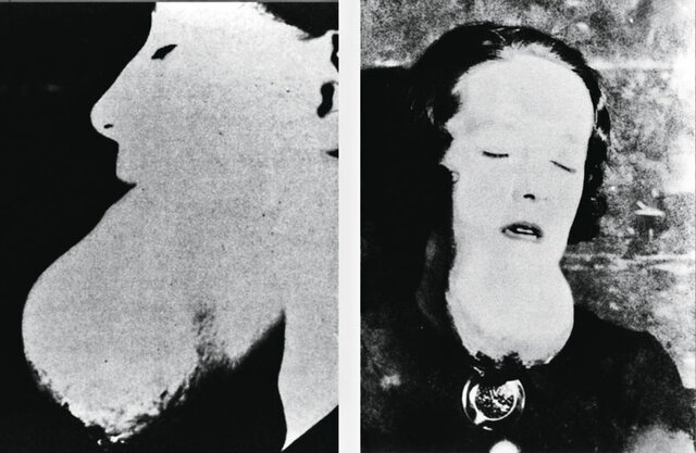 Efectos Biológicos de la radiación- Evento 5