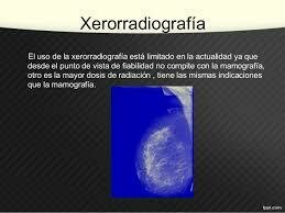 Rayos X  Xerorradiografía - Evento 5