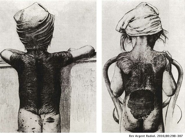 1. Efectos Biológicos.