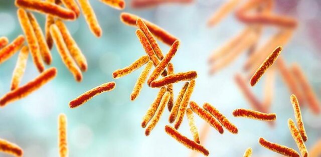 Causa de tuberculosis