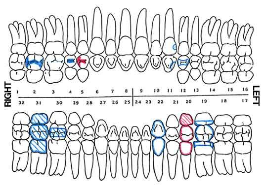 Use of Dental Records