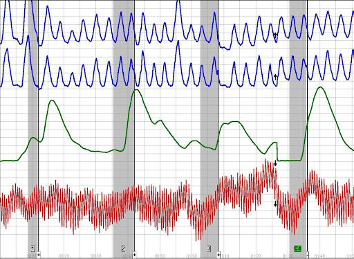Lie Detectors Placed in Police Stations