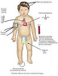 INFLUENCIA DE LAS GUERRAS DEL SIGLO XX
