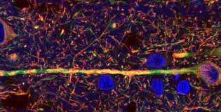 Biomedicina y Neurohistología.