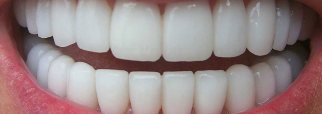 Manufactura en dientes de porcelana