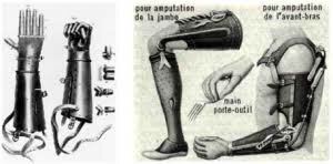 Invención de las prótesis